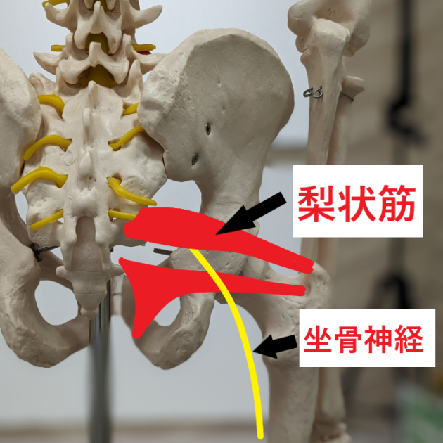 坐骨神経痛.png